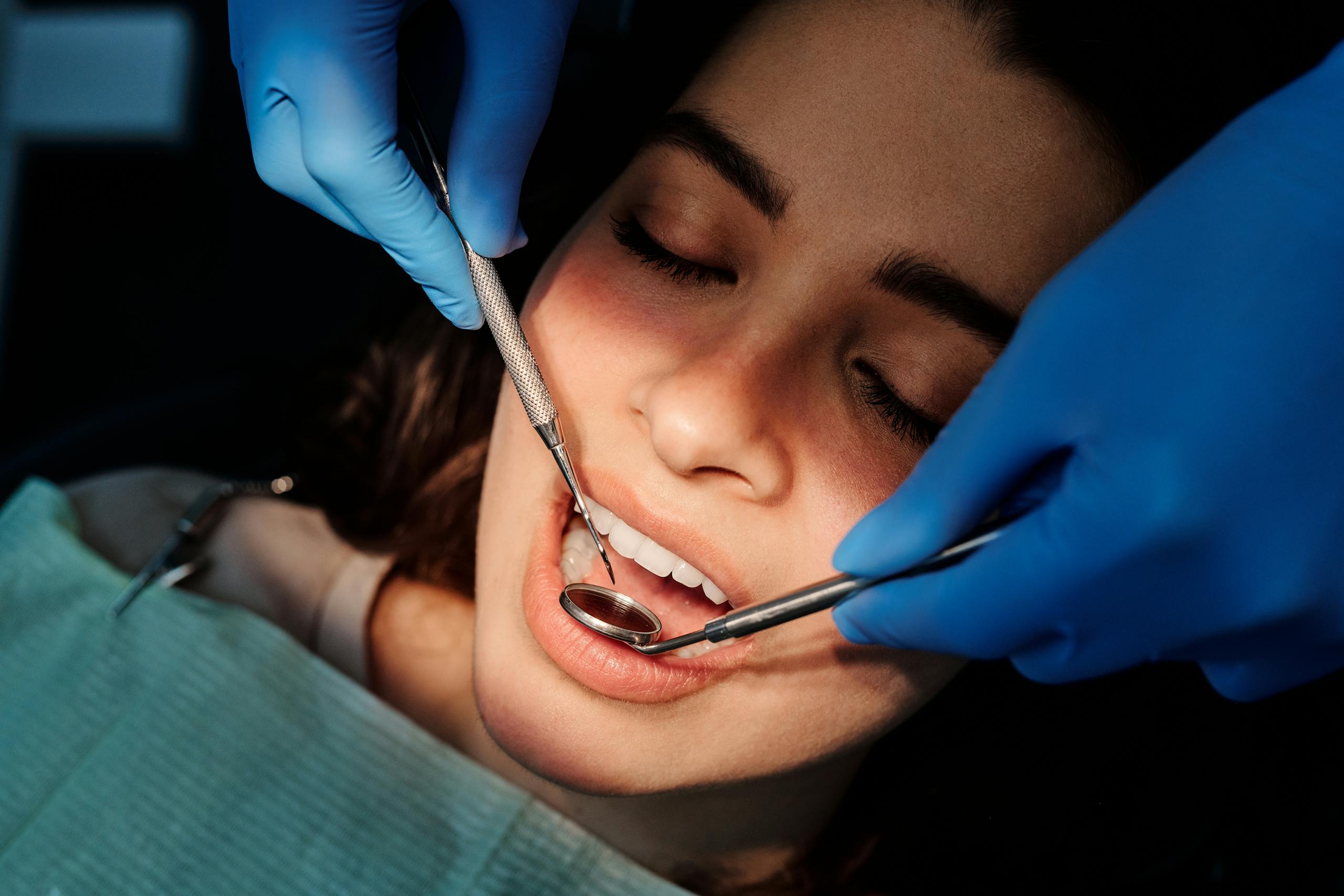 Close-up of a dental examination showing a woman patient receiving dental care from a professional.