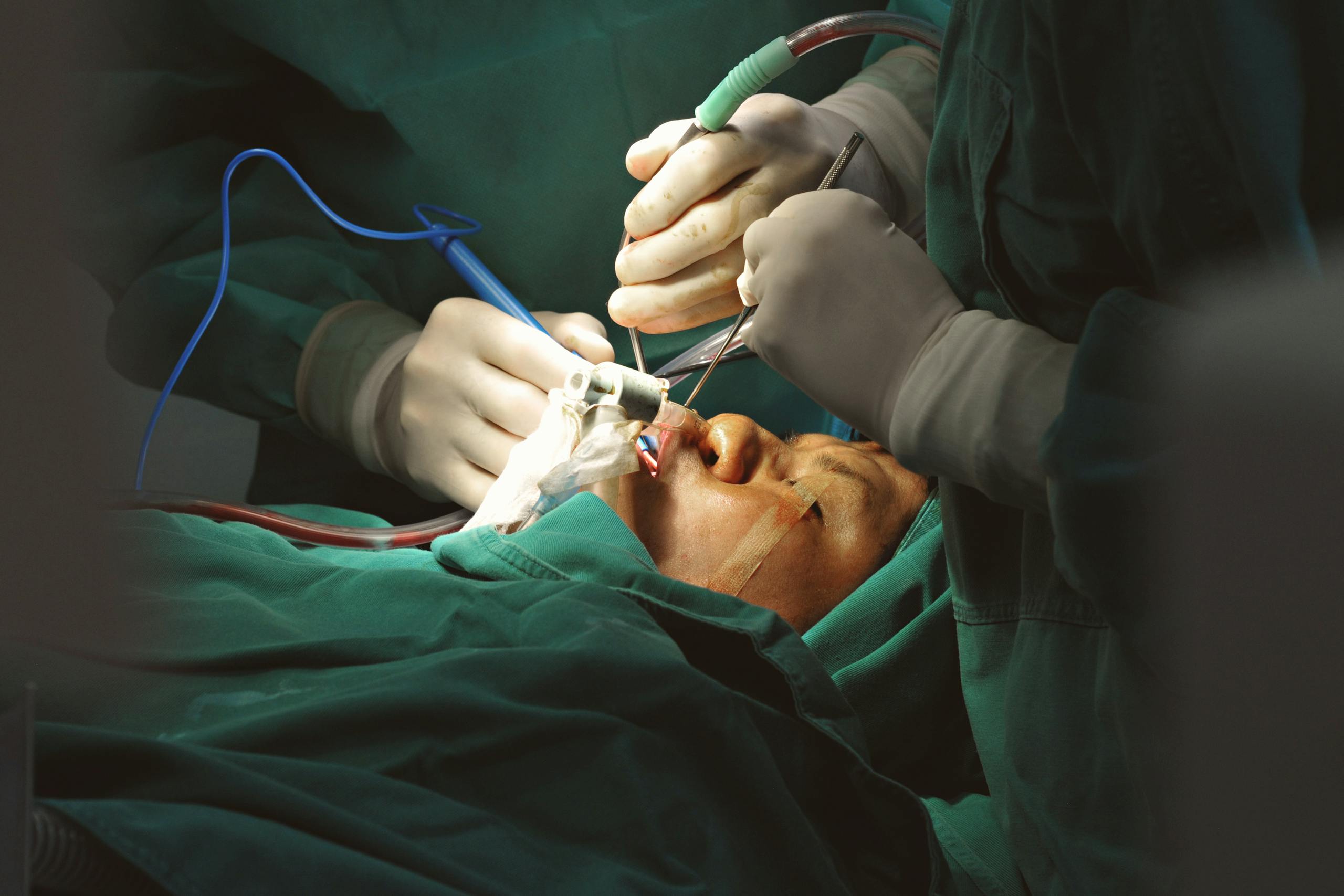 Surgeons in sterile environment performing delicate facial surgery with precision instruments.